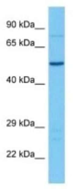 CATIP Rabbit anti-Mouse, Polyclonal, Novus Biologicals 100 &mu;g | Buy Online | Novus Biologicals | Fisher Scientific